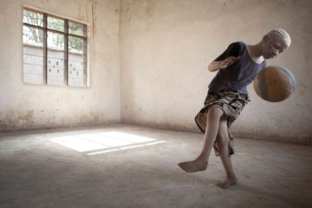 Albinos en Tanzania de Ana Palacios