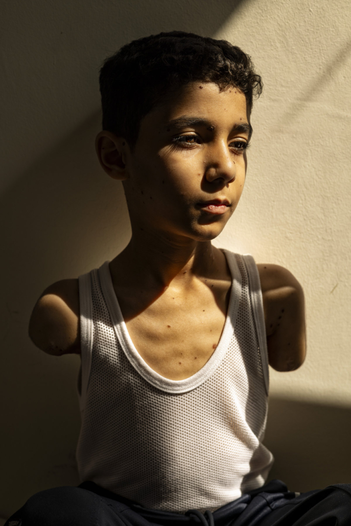 Title: Mahmoud Ajjour, Aged Nine
Credit: © Samar Abu Elouf, for The New York Times